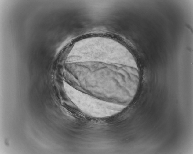 X0000098131400200805151104