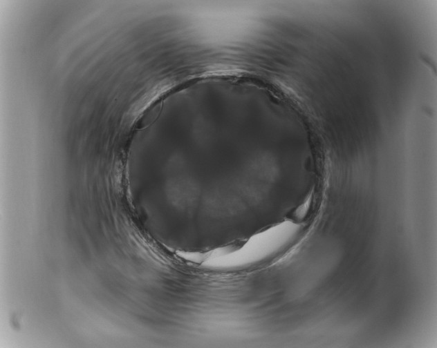 X0000098131401200805151104