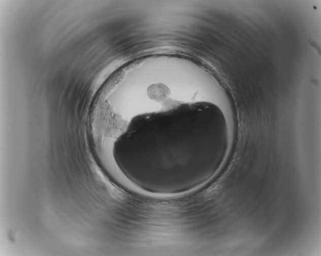 X0000098131418200805151105