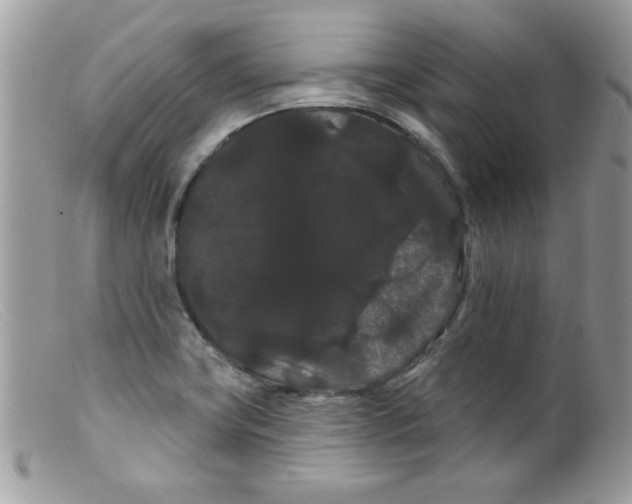 X0000098131419200805151105