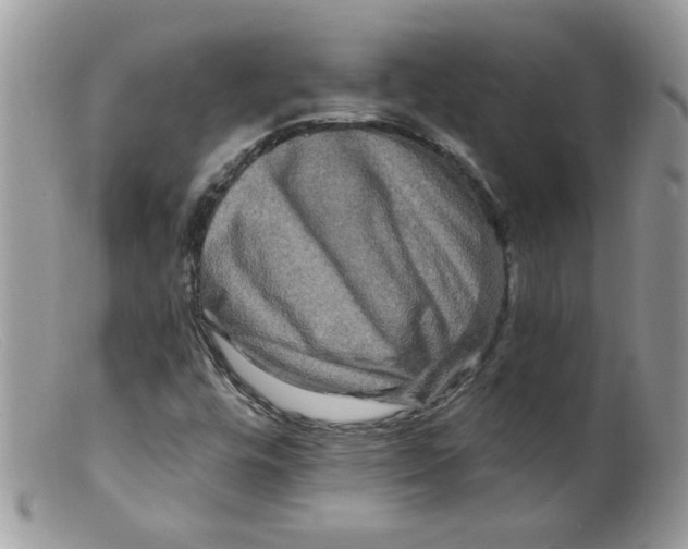 X0000098131448200805151104