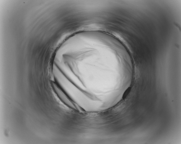 X0000098131477200805151104