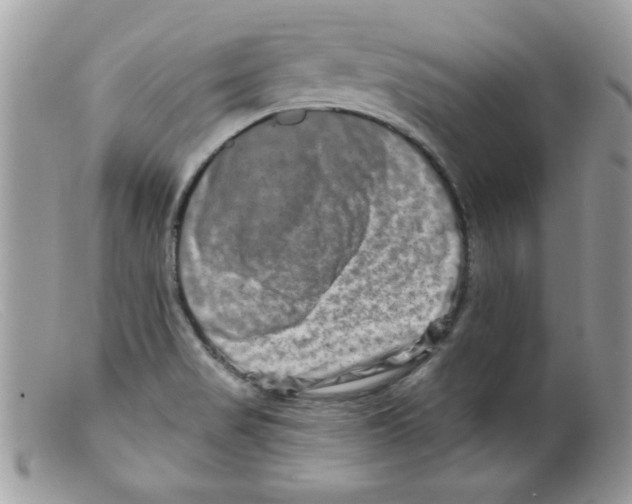 X0000098131517200805151103