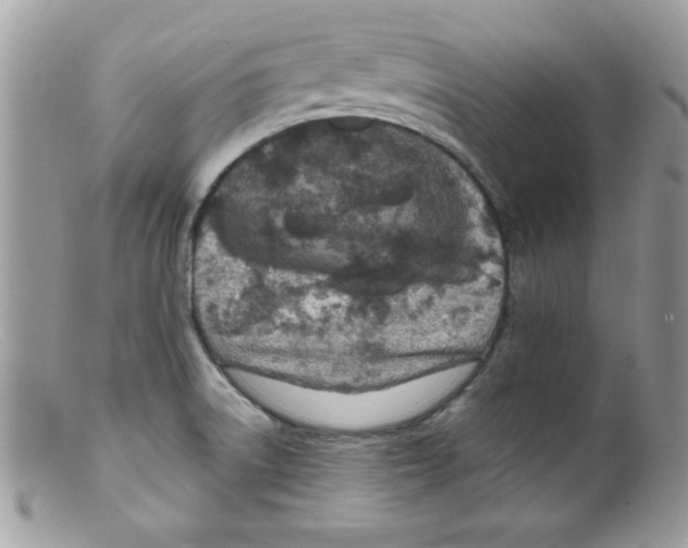 X0000098131522200805151103