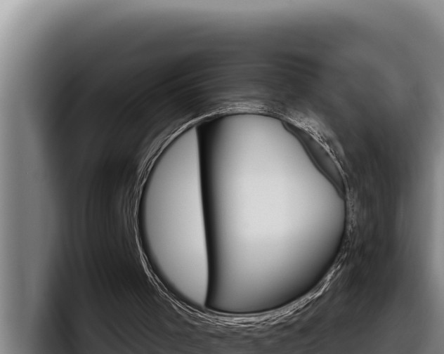 X0000098140001200804171130