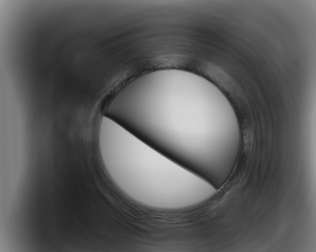 X0000098140254200804171126