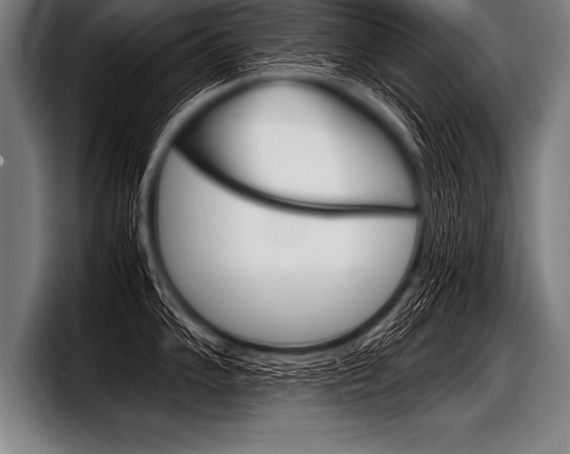 X0000098141102200804171115