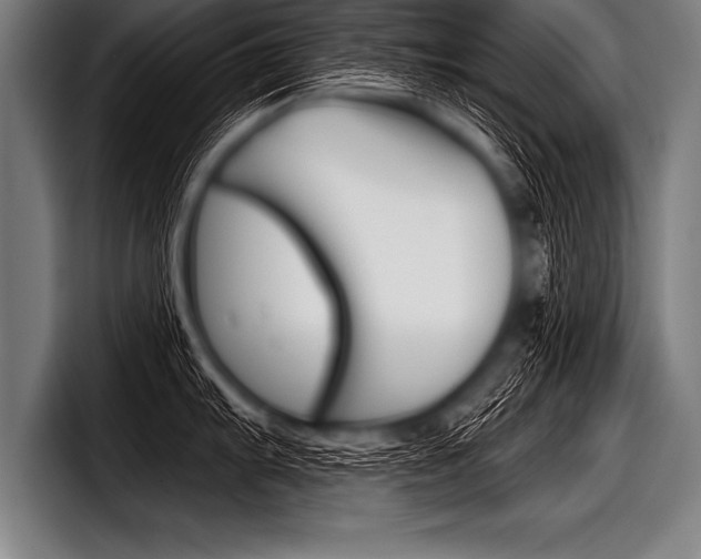X0000098141103200804171115
