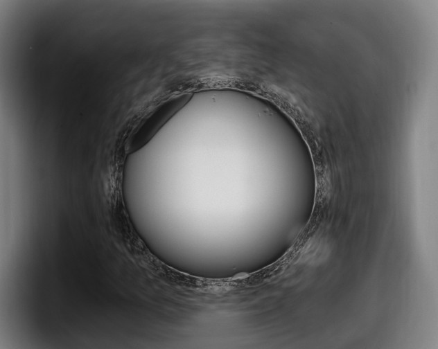 X0000098141157200804171114