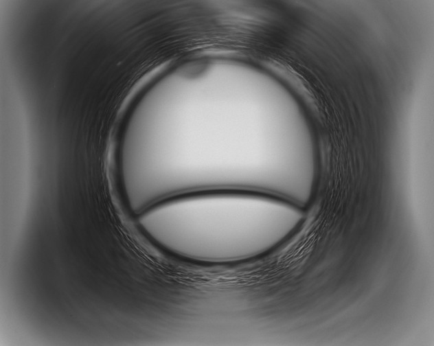 X0000098141198200804171113