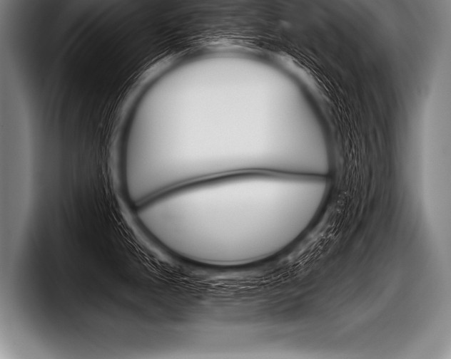 X0000098141247200804171113