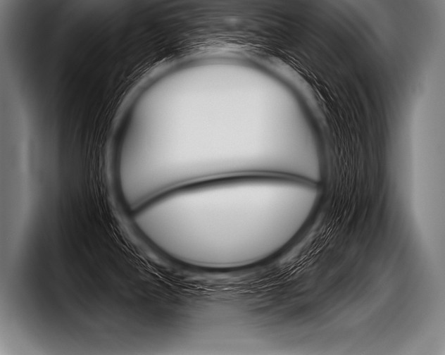 X0000098141390200804171111