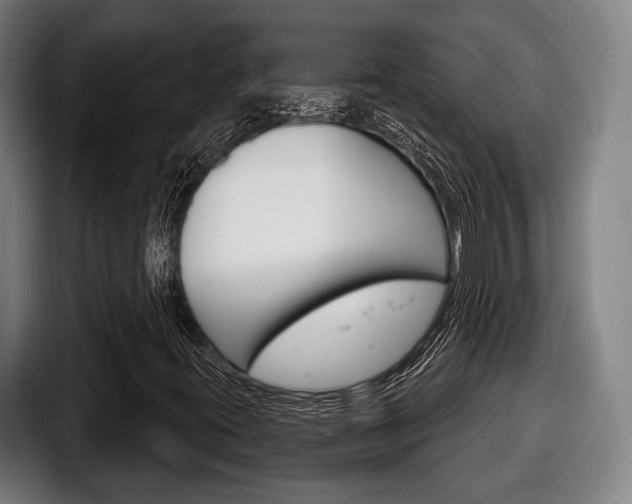 X0000098141395200804171110