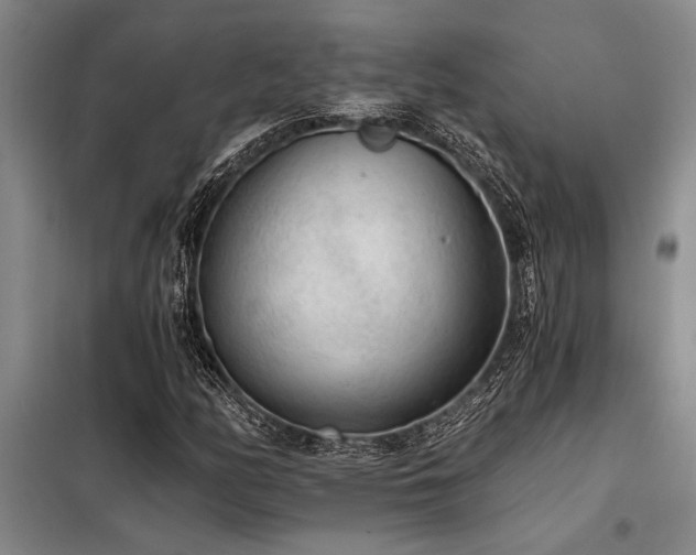 X0000098141158200804171540