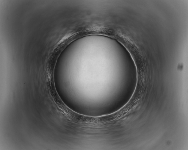 X0000098141206200804171539
