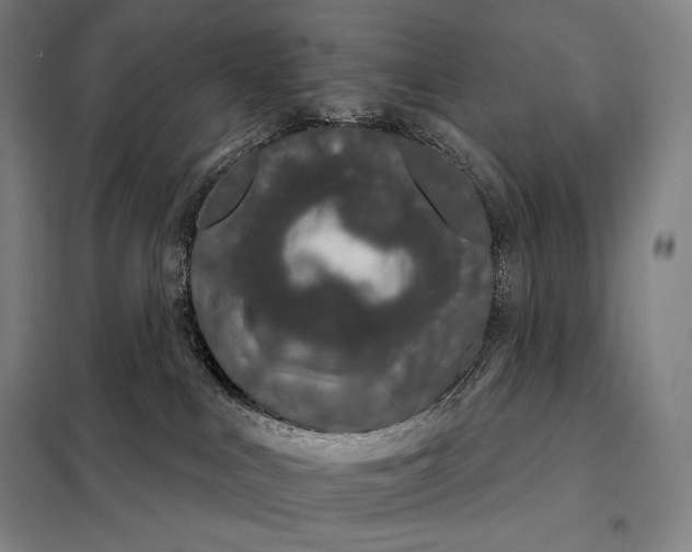 X0000098140043200805011354