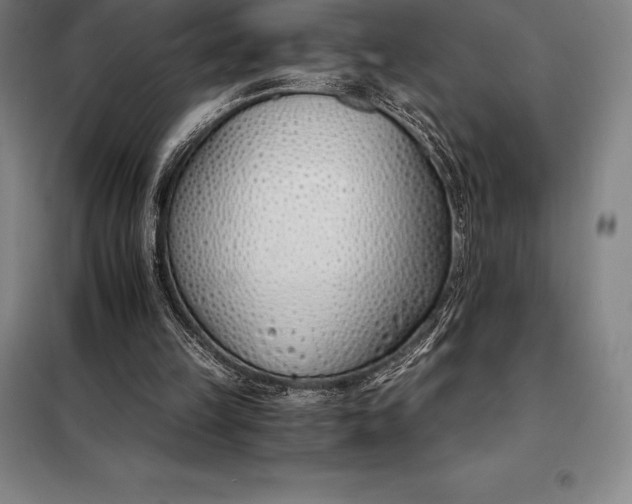 X0000098140149200805011352