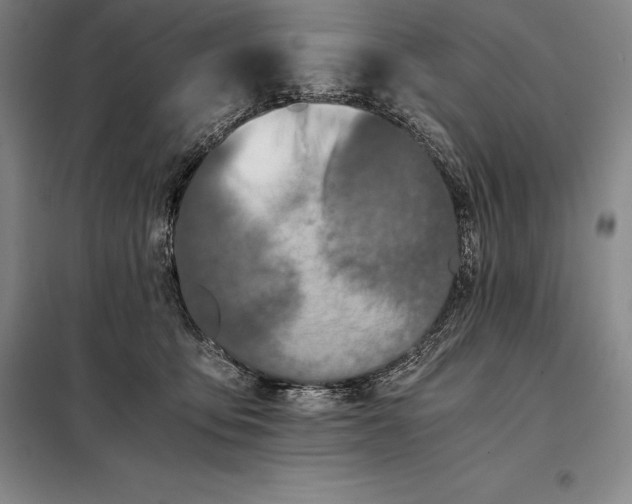 X0000098140419200805011348