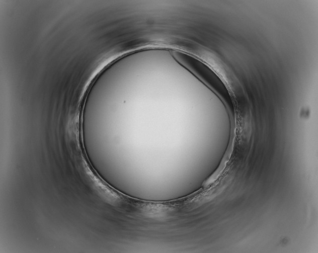 X0000098141100200805011338