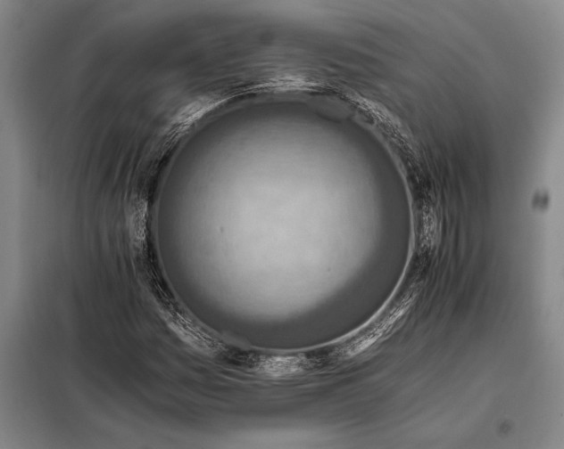 X0000098141161200805011337