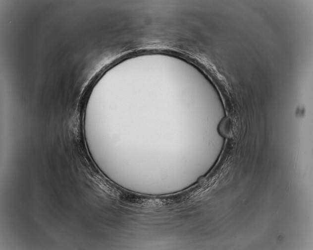 X0000098141167200805011337