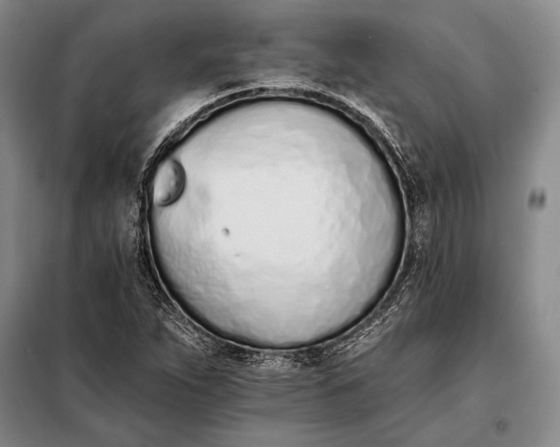 X0000098141263200805011336
