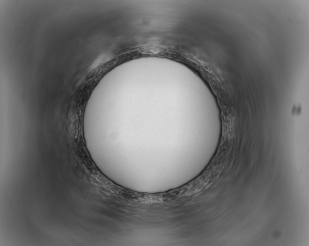 X0000098141446200805011333