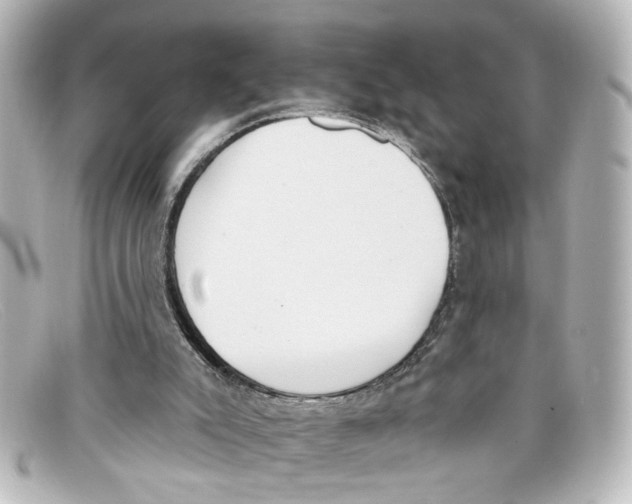 X0000098140007200805081030