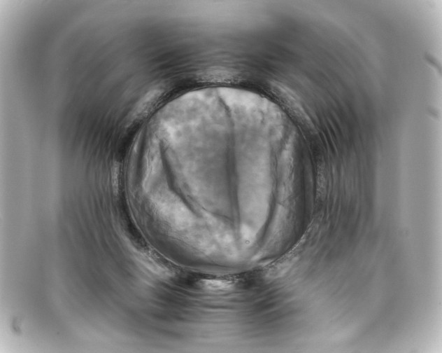 X0000098140167200805081028