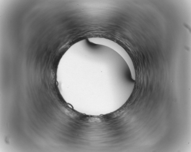 X0000098140572200805081023