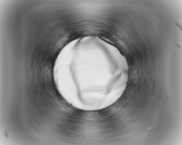 X0000098140716200805081020