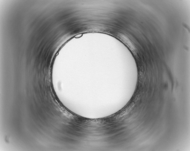 X0000098140948200805081017