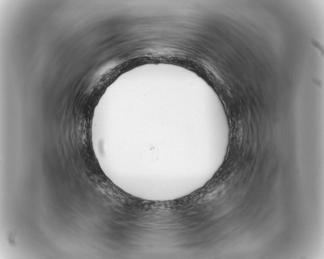 X0000098141016200805081015