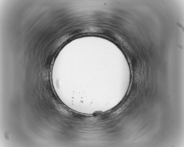 X0000098141017200805081015