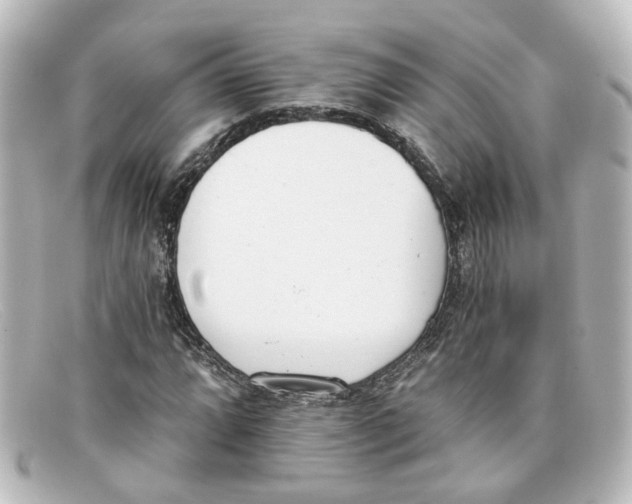 X0000098141064200805081015