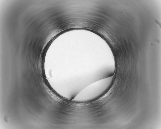 X0000098141122200805081014