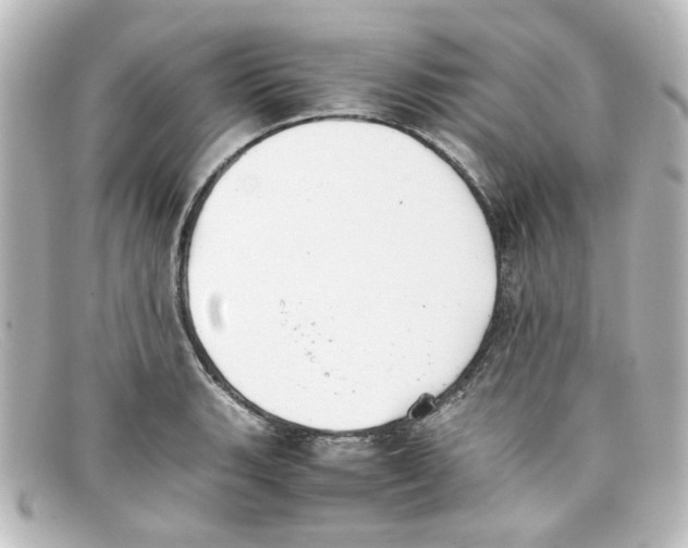 X0000098141135200805081014