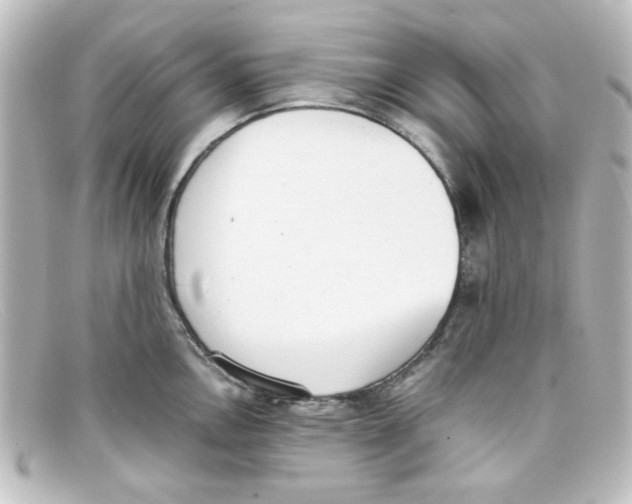 X0000098141146200805081014
