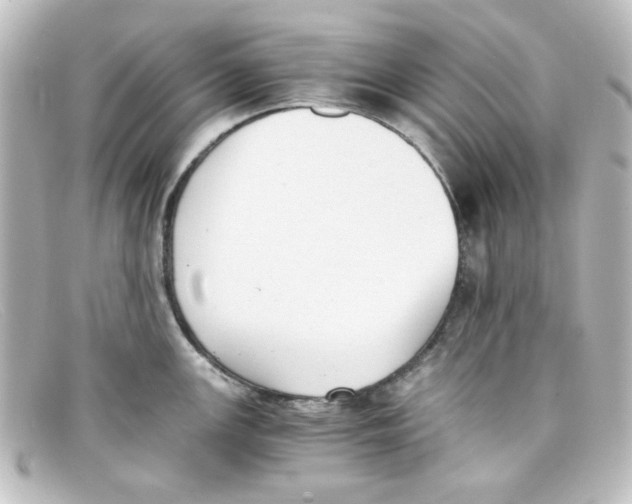 X0000098141147200805081014