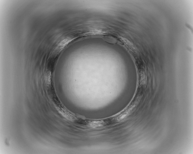 X0000098141161200805081013