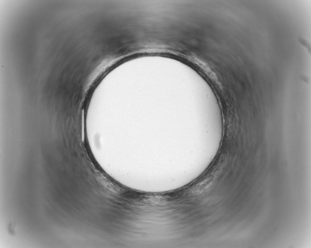 X0000098141175200805081013