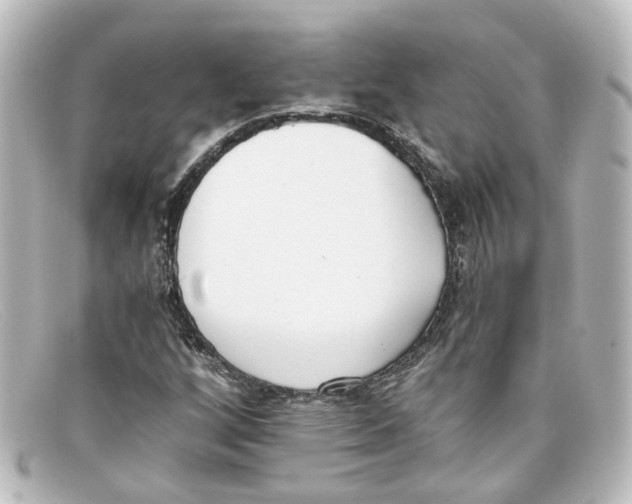 X0000098141256200805081012