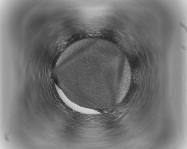 X0000098141298200805081011