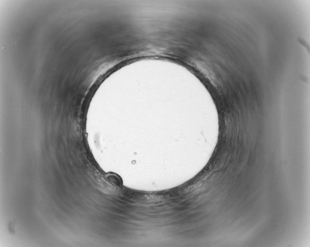 X0000098141308200805081011