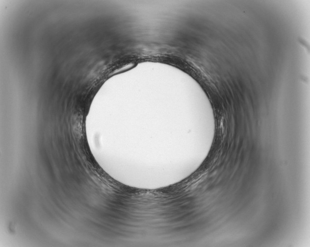 X0000098141348200805081011