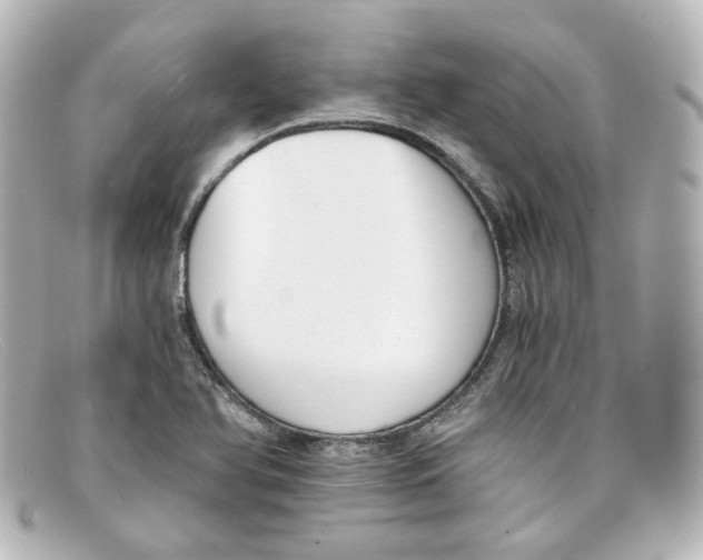 X0000098141366200805081011