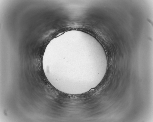 X0000098141398200805081010