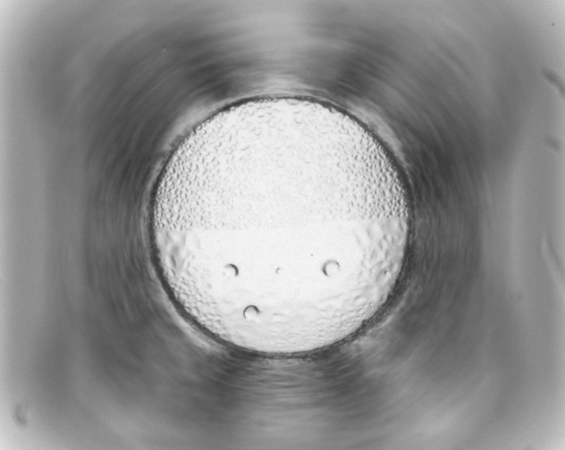 X0000098141429200805081010