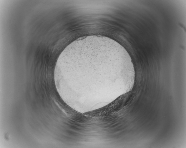 X0000098140405200805151145