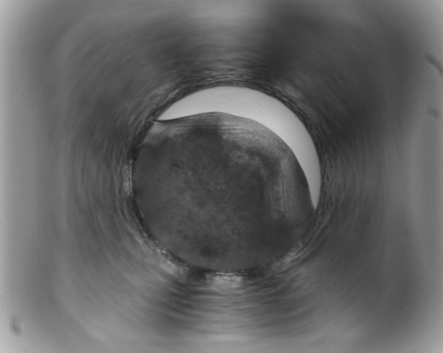 X0000098140471200805151145